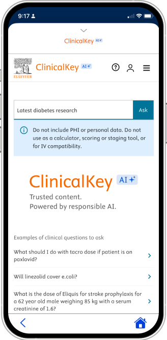 Natural Language Conversational Search